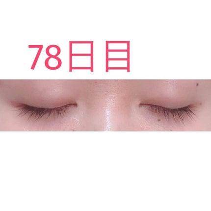 ラッシュアディクト アイラッシュコンディショニングセラム/soaddicted/まつげ美容液を使ったクチコミ(1枚目)