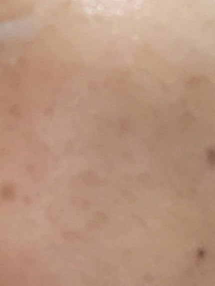 プレディア スパ・エ・メール ファンゴ W クレンズ/Prédia/クレンジングクリームを使ったクチコミ(6枚目)