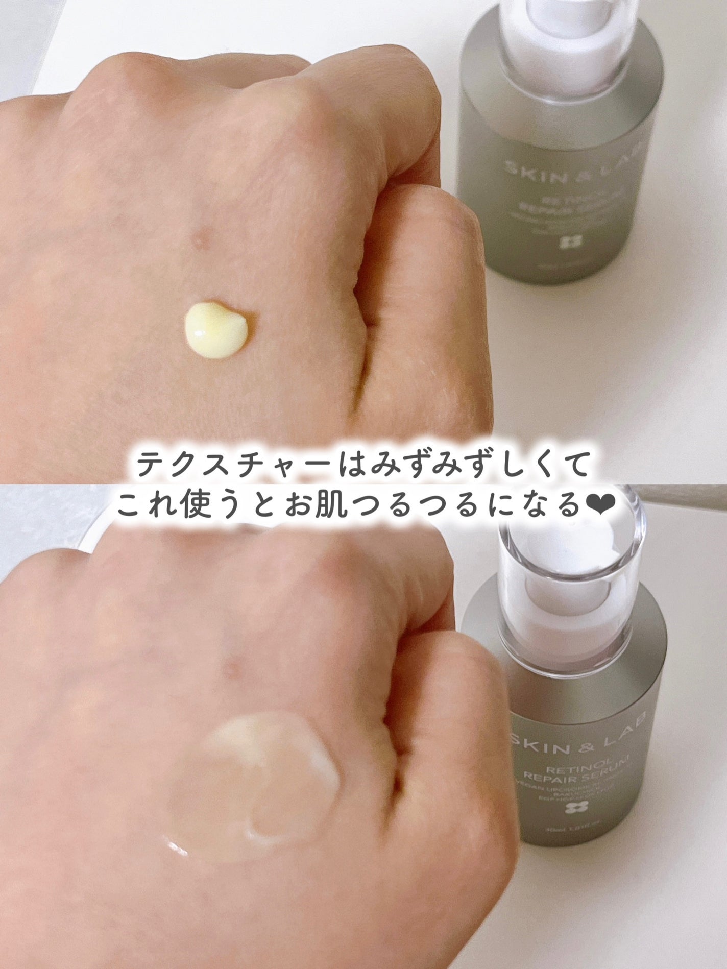 ヴィーガンリポソームレチノールセラム/SKIN&LAB/美容液を使ったクチコミ(3枚目)