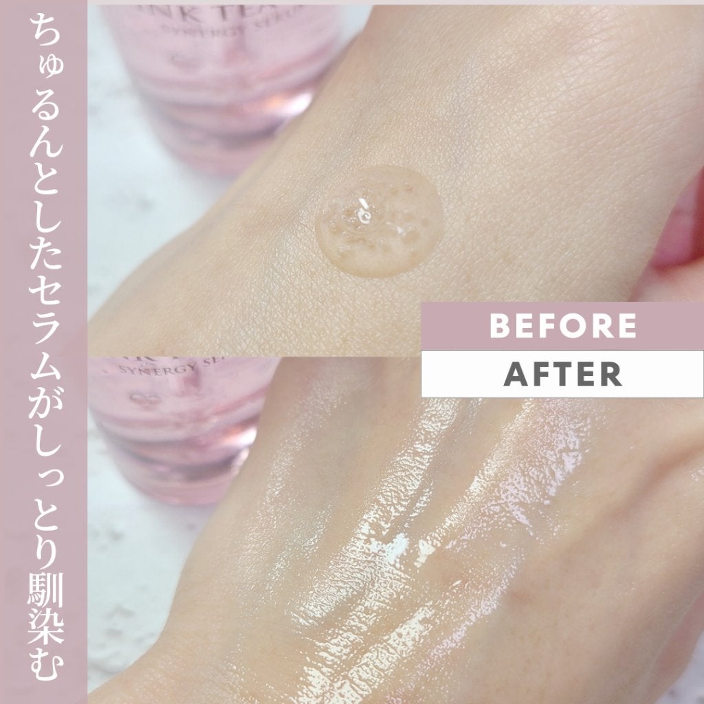 ピンクティーツリーシナジーセラム/APLIN/美容液を使ったクチコミ(4枚目)