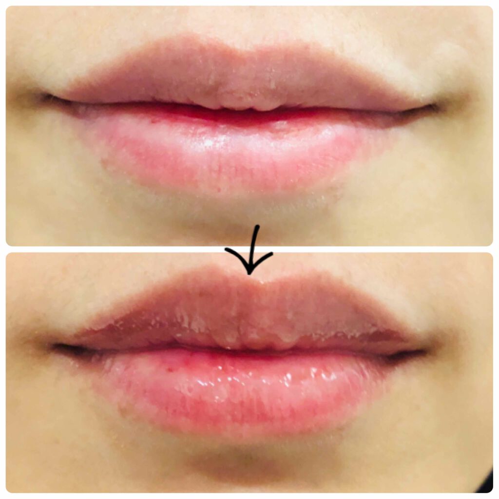 リッププランパー/メークソリューション/リッププランパーを使ったクチコミ（2枚目）