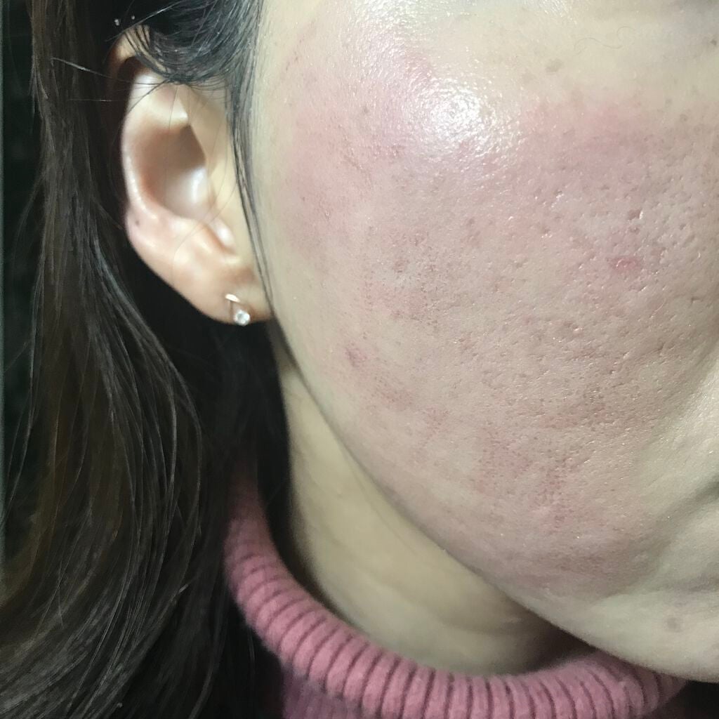 ナチュラル チークN/CEZANNE/パウダーチークを使ったクチコミ(8枚目)