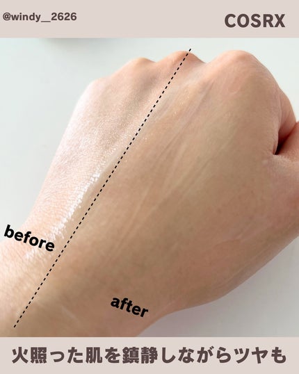 RXザ・AHA2 BHA2 ブラミッシュトリートメントセラムコットン/COSRX/美容液を使ったクチコミ(4枚目)