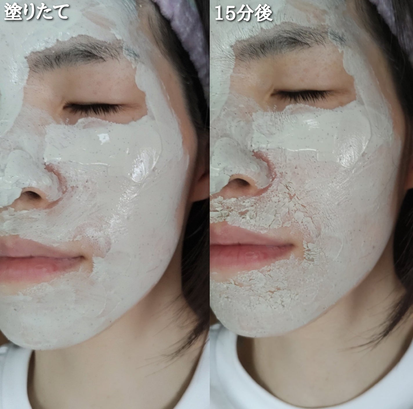 グリーンマスク/Torhop/洗い流すパック・マスクを使ったクチコミ(5枚目)