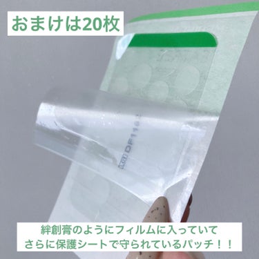 カシー スポッツのクチコミ「本当にニキビって困りますよね🐶💦
大事な時こそできる嫌なやつ…
✼••┈┈••✼••┈┈••✼.....」（2枚目）