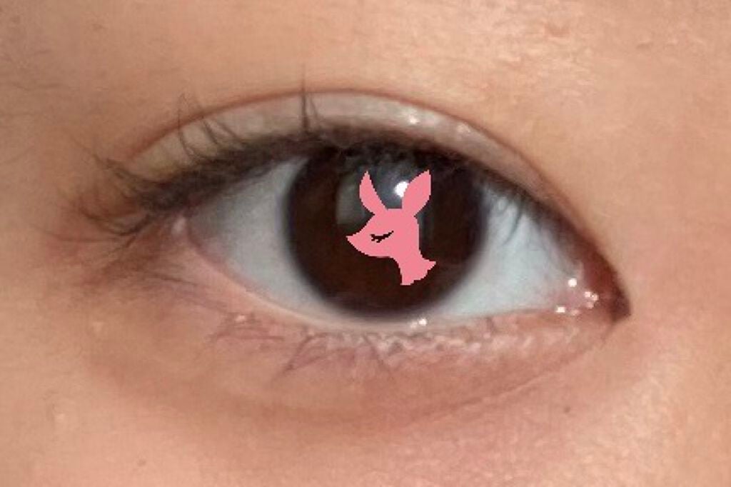 ♡こじか♡ on LIPS 「こんにちは!こじかです!🦌今回は、蒙古襞がある目頭を切開ライン..」(3枚目)