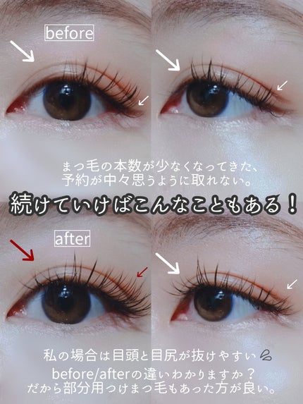 ðððð â¡â» on LIPS ã裞çŒã§ãç®å
ãã§ã³ãžããæ¹æ³â§Ëââãããšã¯åŸ¹åºå説ïŒïŒ---..ãïŒ6æç®ïŒ