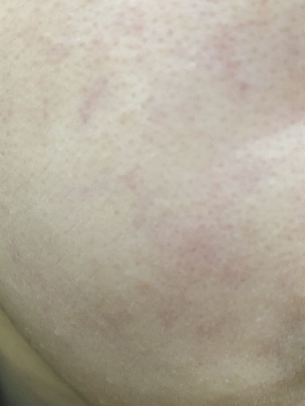 リサージ ミルクオイル 50ml/リサージ/美容液を使ったクチコミ（2枚目）