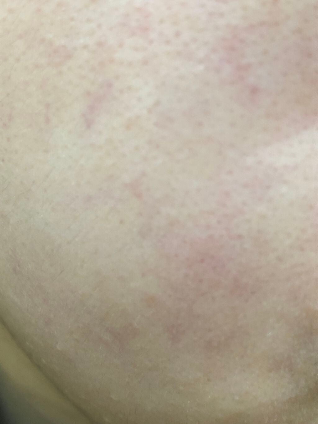 リサージ ミルクオイル/リサージ/美容液を使ったクチコミ(2枚目)