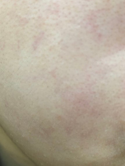 リサージ ミルクオイル/リサージ/美容液を使ったクチコミ(2枚目)