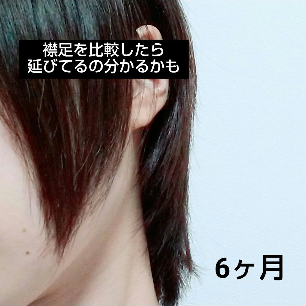 ヘアアクセルレーター フローラルの香り/加美乃素本舗/頭皮ローションを使ったクチコミ(4枚目)