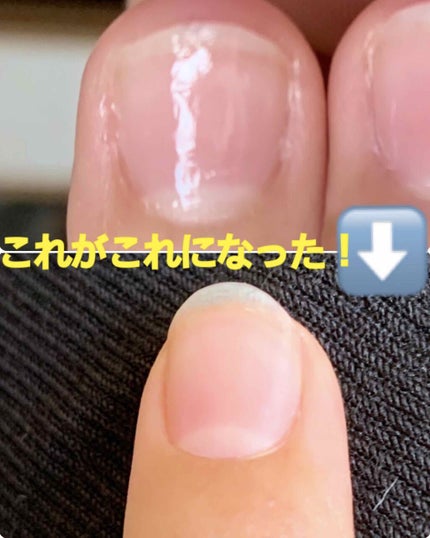 ハトムギ化粧水(ナチュリエ スキンコンディショナー R )/ナチュリエ/化粧水を使ったクチコミ(1枚目)
