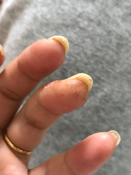 ジェルネイル(ライト対応)/セリア/ジェルネイルを使ったクチコミ(4枚目)