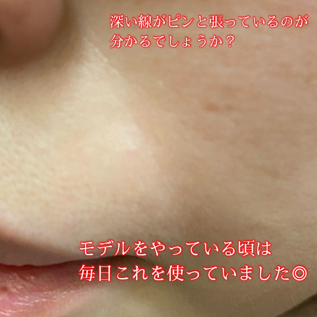 肌ふっくら アイゾーンマスク/クリアターン/シートマスク・パックを使ったクチコミ(4枚目)