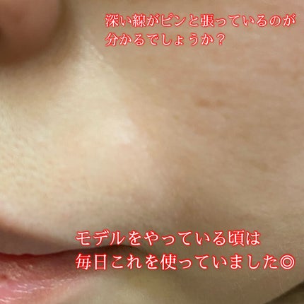 肌ふっくら アイゾーンマスク/クリアターン/シートマスク・パックを使ったクチコミ(4枚目)