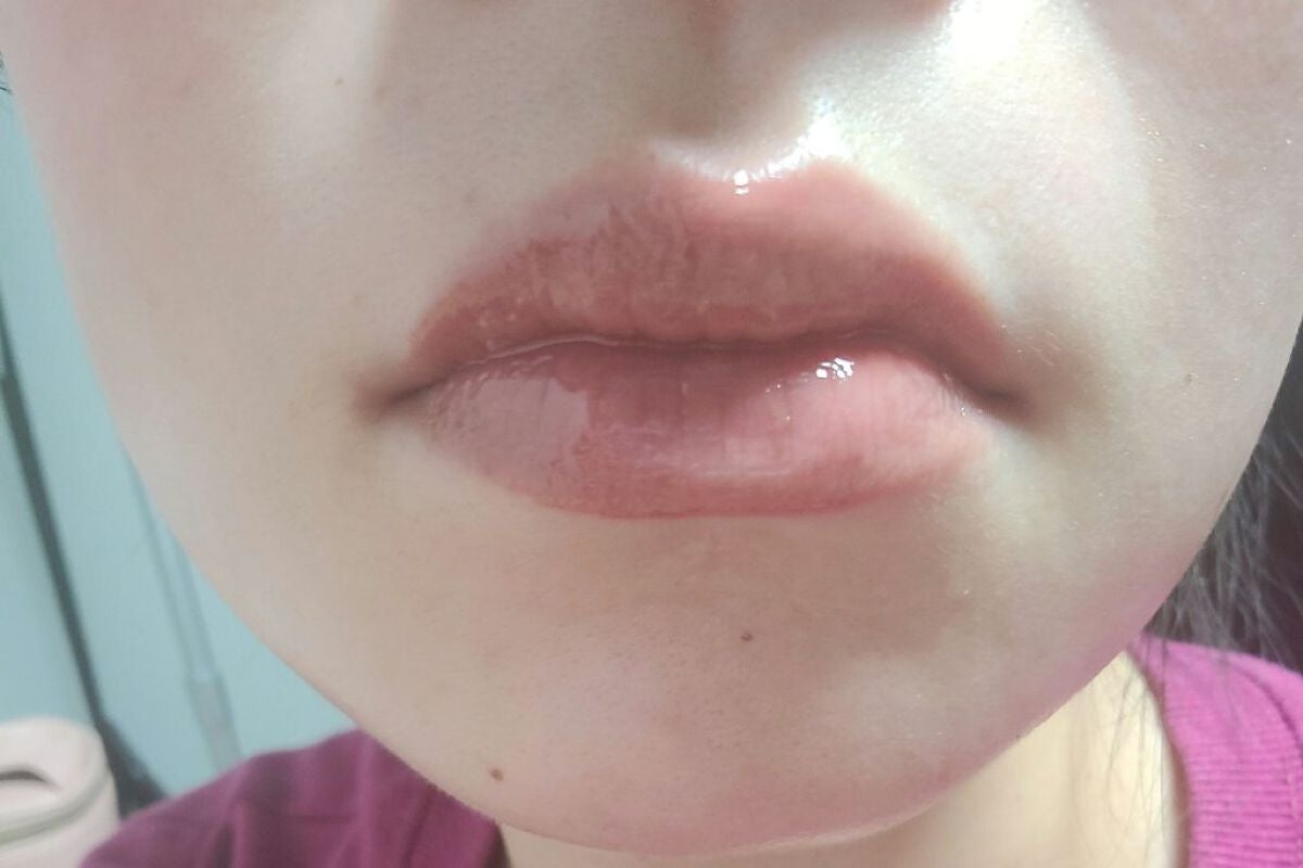 センシュアルヌードグロス/HERA/リップグロスを使ったクチコミ(5枚目)