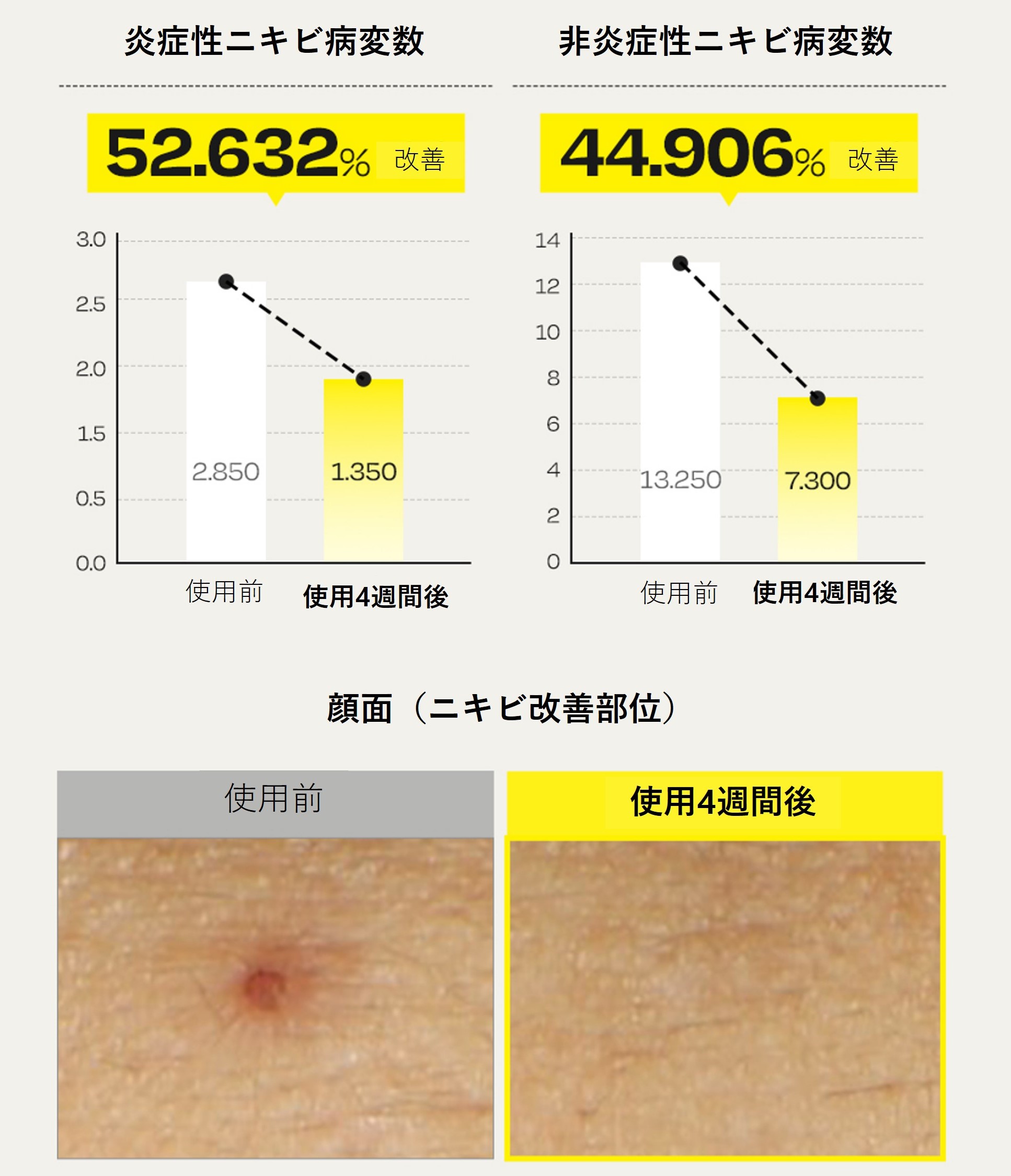 ダルバ ホワイトトリュフファーストスプレーセラム/ダルバ/ミスト状化粧水を使ったクチコミ（3枚目）