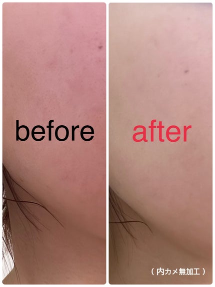 ウォンジョンヨ フィッティングクッション ラスティング/Wonjungyo/クッションファンデーションを使ったクチコミ(2枚目)