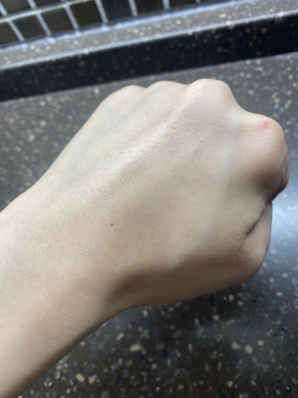 薬用アクネケアミスト/オードメディカ/ミスト状化粧水を使ったクチコミ（2枚目）