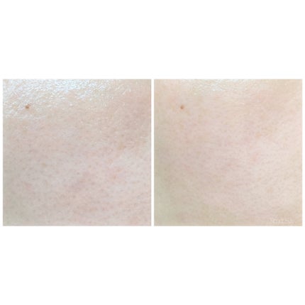 リードルショット300/VT/美容液を使ったクチコミ(9枚目)