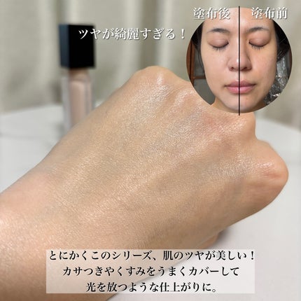 BIONIA コレクティングコンシーラー/コラリッチ/コンシーラーを使ったクチコミ(9枚目)