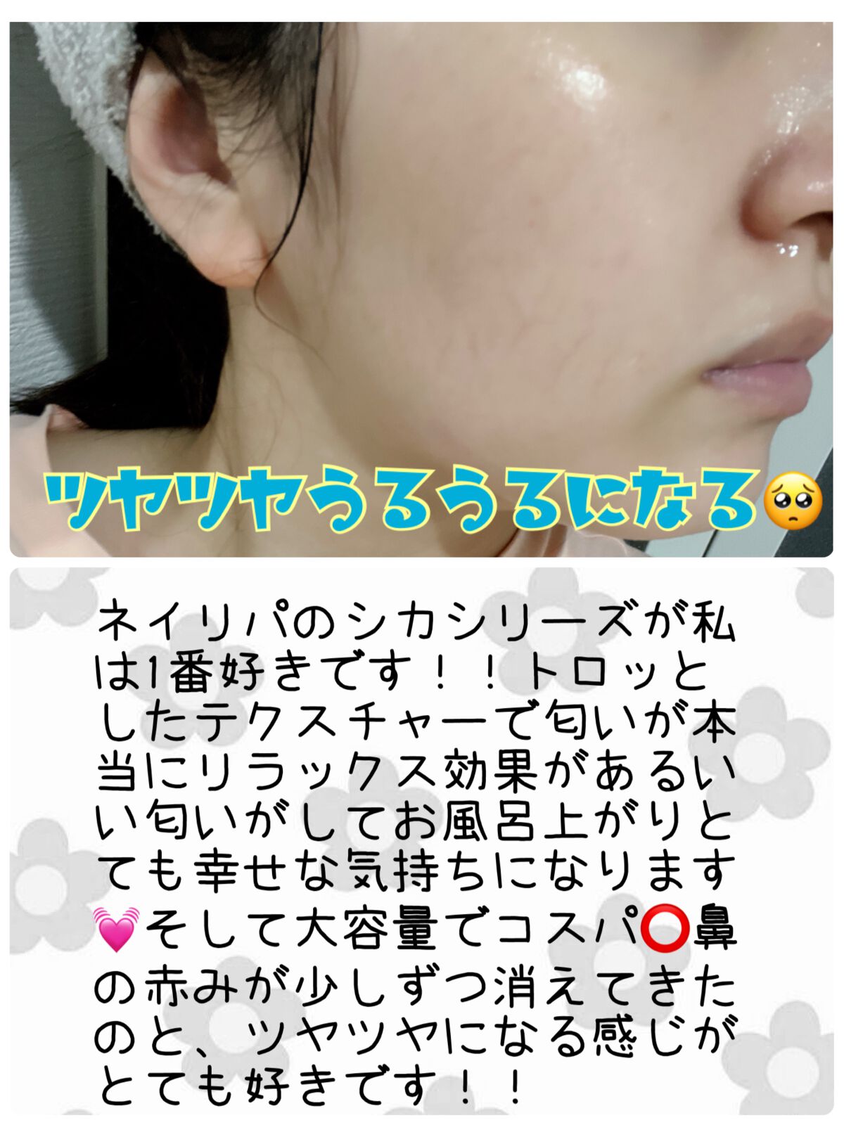 グリーン ダーマCICAビックトナー/ネイチャーリパブリック/化粧水を使ったクチコミ（2枚目）