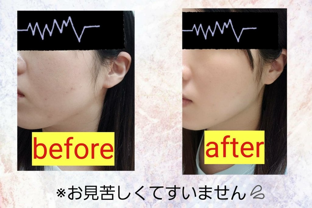 ビタミンミルク/ASUNE /乳液を使ったクチコミ(2枚目)