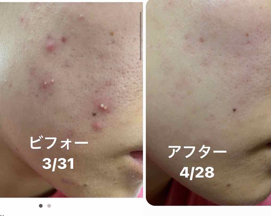 イハダ 薬用クリアバーム/IHADA/フェイスバームを使ったクチコミ(1枚目)