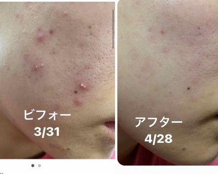 イハダ 薬用クリアバーム/IHADA/フェイスバームを使ったクチコミ(1枚目)