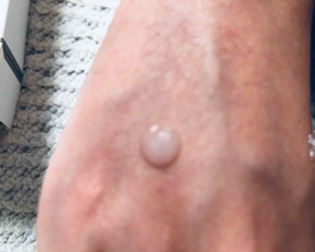 Perfect Lifty TOTAL LIFTING GEL CREAM/R&/フェイスクリームを使ったクチコミ(2枚目)