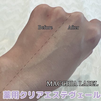 薬用クリアエステヴェール/Macchia Label/リキッドファンデーションを使ったクチコミ(3枚目)