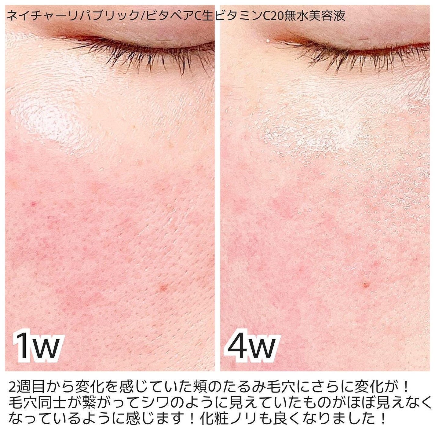 ビタペアCデイリーシートマスク/ネイチャーリパブリック/シートマスク・パックを使ったクチコミ(2枚目)