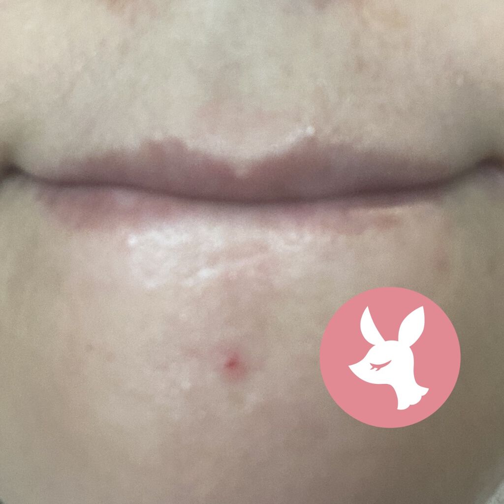 オリーブヤング ケアプラス/Olive Young/その他を使ったクチコミ（3枚目）