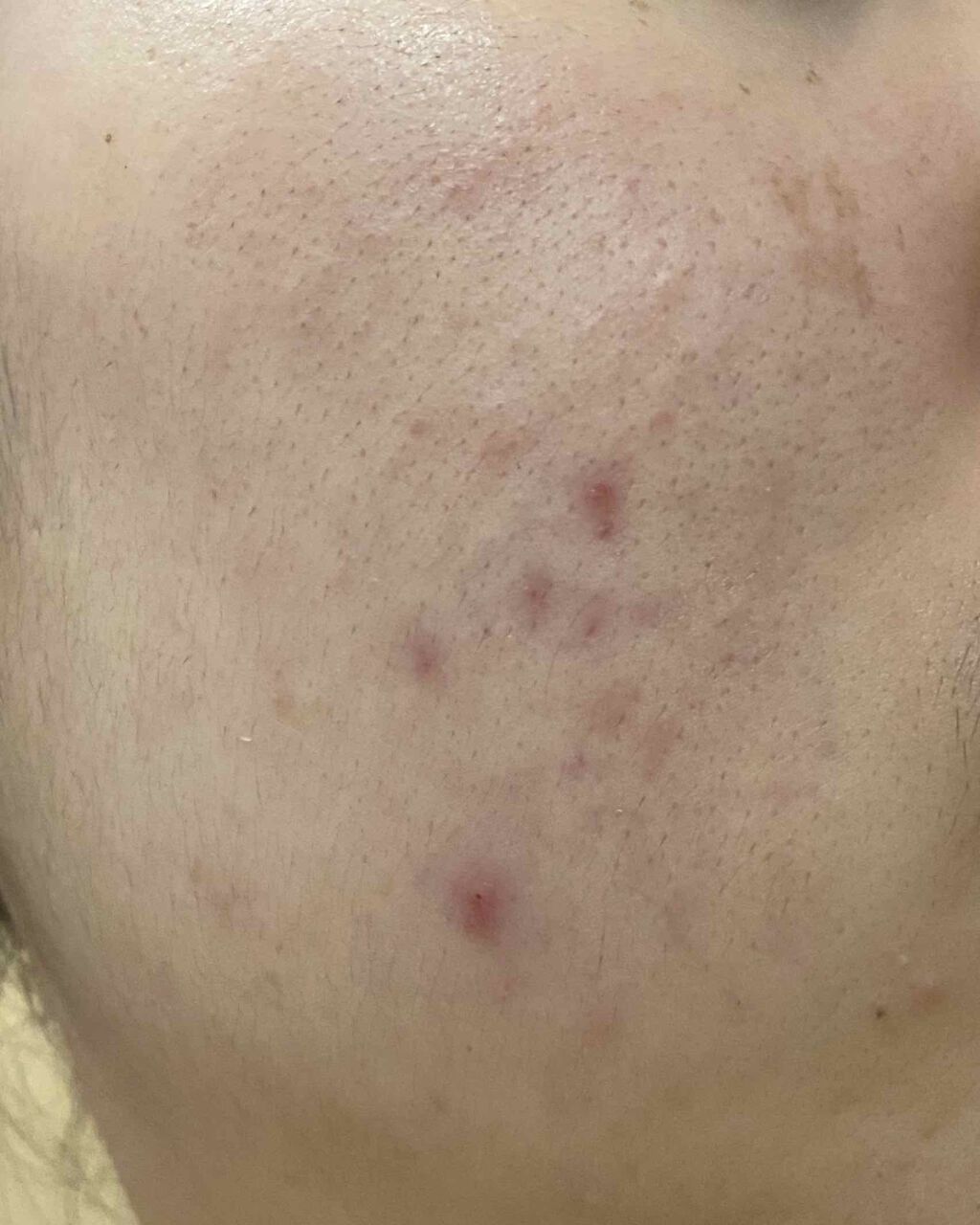 Cセラム/b.glen/美容液を使ったクチコミ（2枚目）