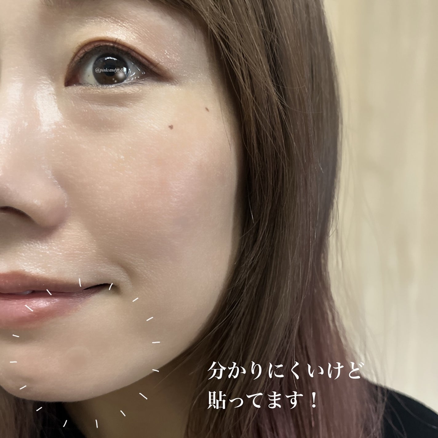 ビューティー スポットパッチ/イージーダムビューティー/にきびパッチを使ったクチコミ(7枚目)
