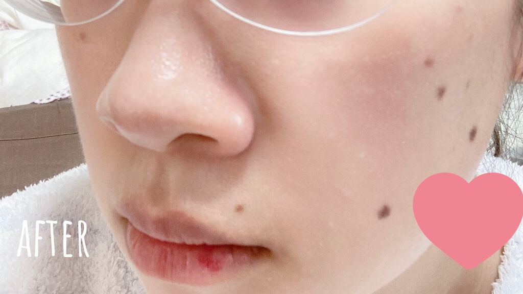 UVイデア XL プロテクショントーンアップ/ラ ロッシュ ポゼ/日焼け止めクリームを使ったクチコミ(3枚目)