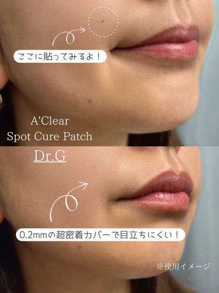 エイクリアスポットキュアパッチ/Dr.G/その他スキンケアを使ったクチコミ(7枚目)