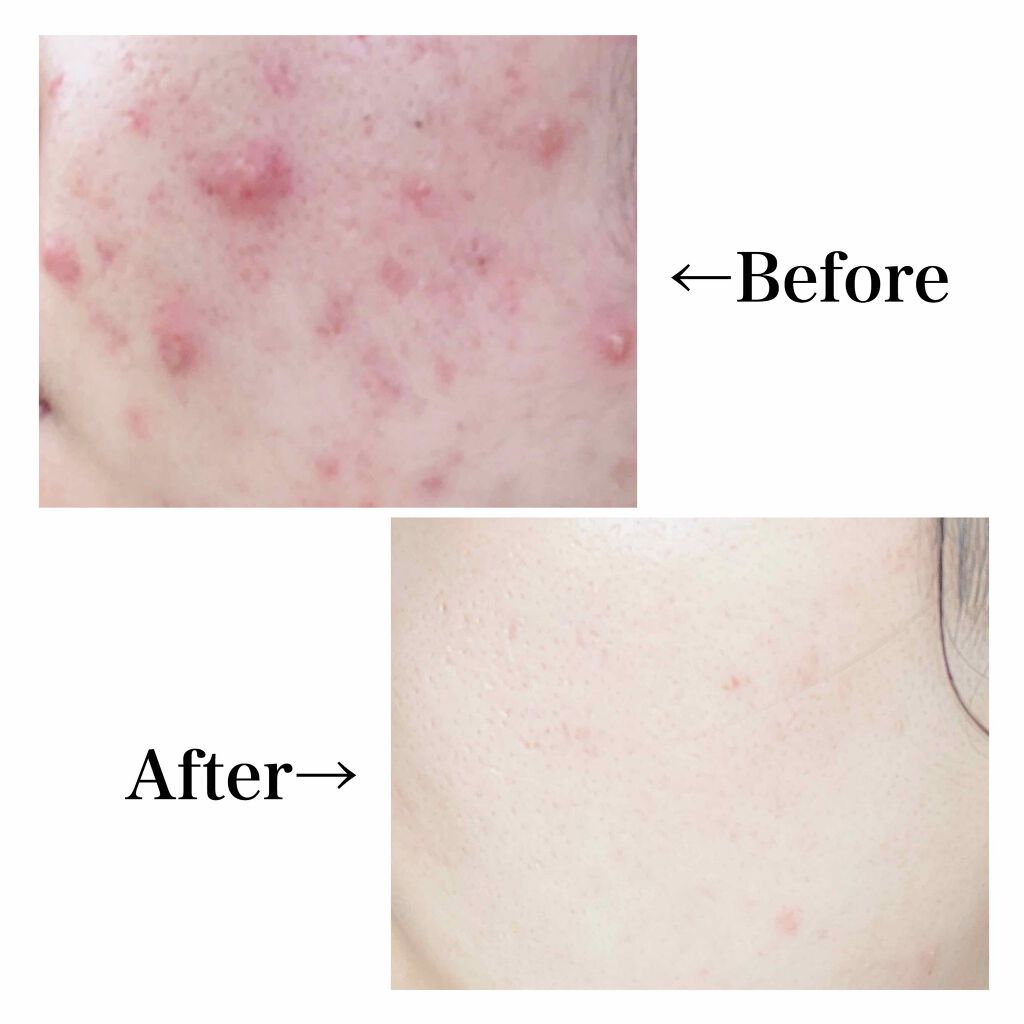 サンホワイトP-1/サンホワイト/ボディクリームを使ったクチコミ（2枚目）