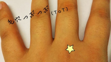 脱毛ラボ ホームエディション/脱毛ラボ/家庭用脱毛器を使ったクチコミ(3枚目)