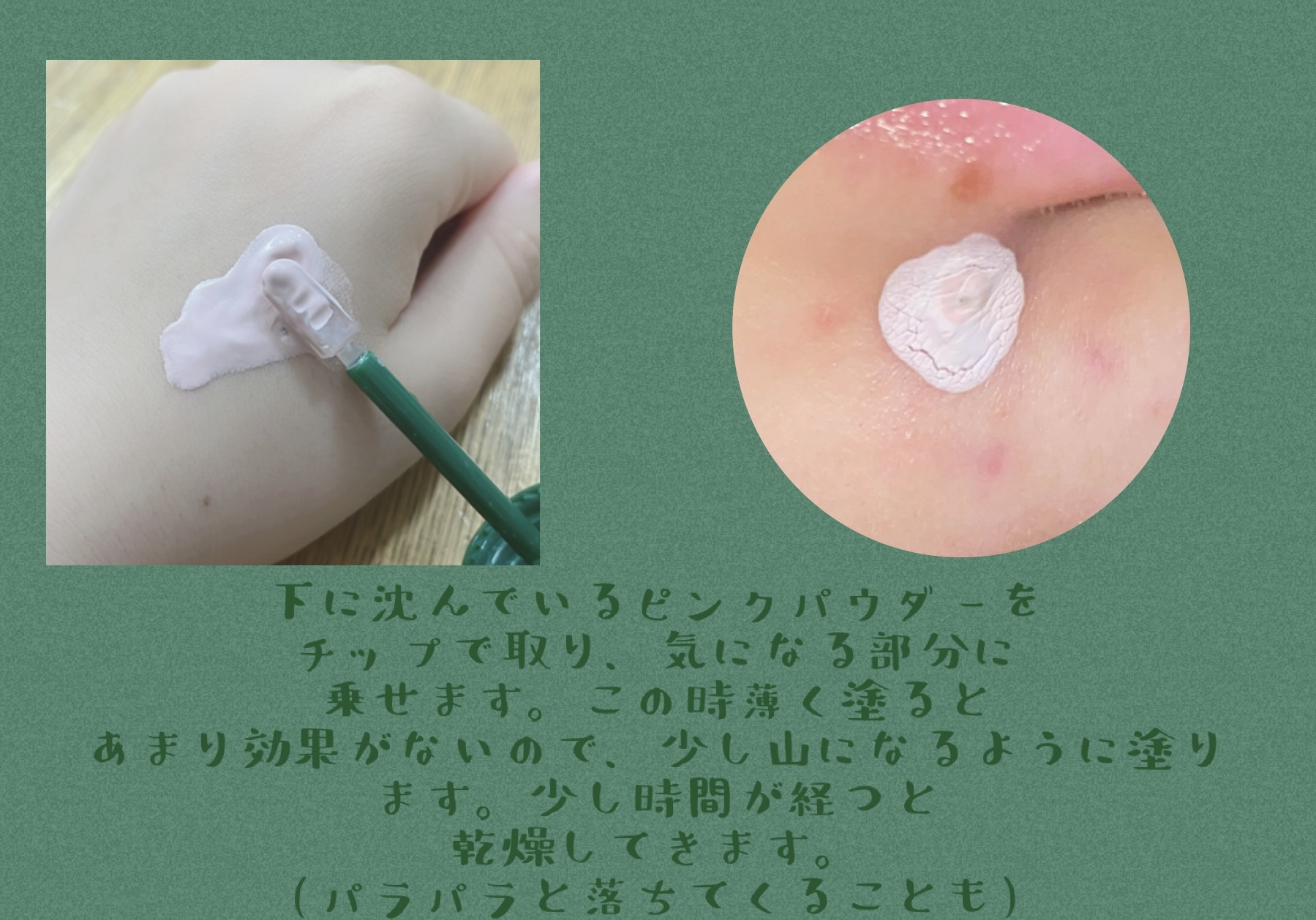 プロ シカ フォーカシング スポット ピンク パウダー/VT/その他スキンケアを使ったクチコミ（3枚目）
