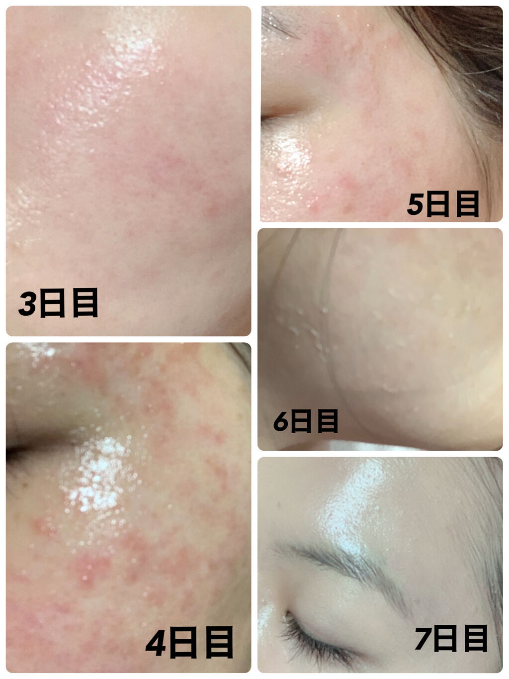 レチノールA 1% アドバンスドリバイタリゼーションクリーム/Life-flo/フェイスクリームを使ったクチコミ（2枚目）