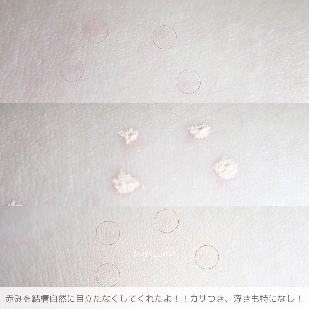 ダーマシンコンシーラー/23years old/リキッドコンシーラーを使ったクチコミ(4枚目)