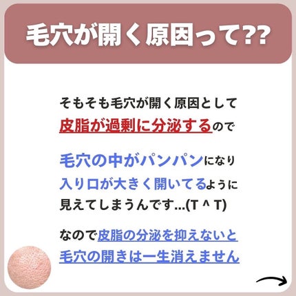あなたの肌に合ったスキンケア💐コーくん先生 on LIPS 「【コレ知らない人まじ危険】こんな人は毛穴一生消えません。..あ..」(4枚目)