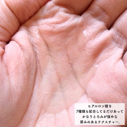 アクアヒアルロニックエッセンス/ロベクチン/化粧水を使ったクチコミ(5枚目)