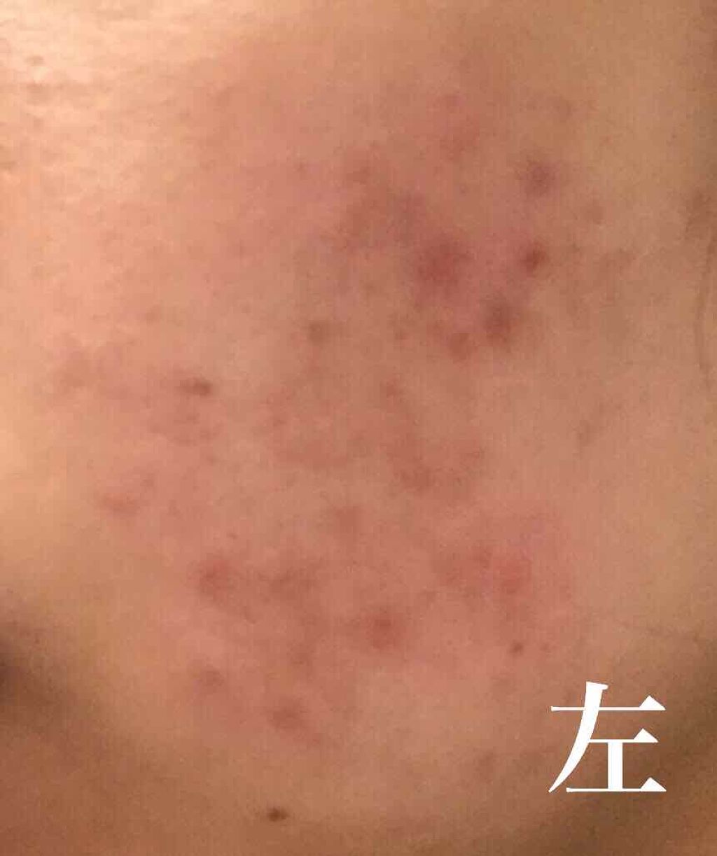 ロゼット洗顔パスタ 海泥スムース/ロゼット/洗顔フォームを使ったクチコミ（3枚目）