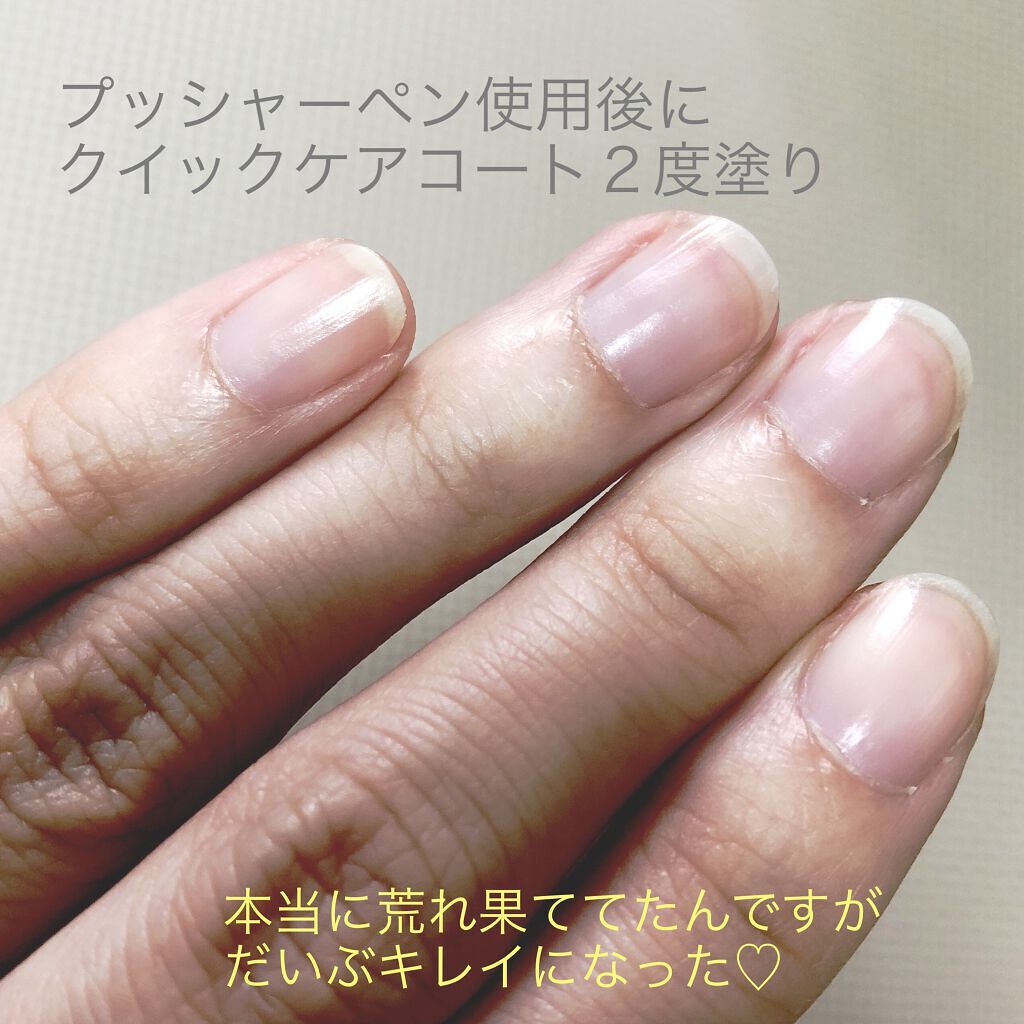 ミニネイル/パラドゥ/マニキュアを使ったクチコミ（3枚目）