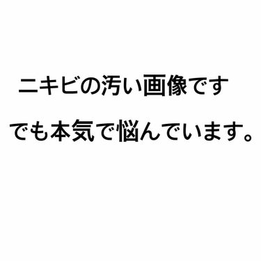 coral_glow_34g on LIPS 「元からニキビが酷かったですがいきなりこんなに酷くなってしまいま..」（1枚目）