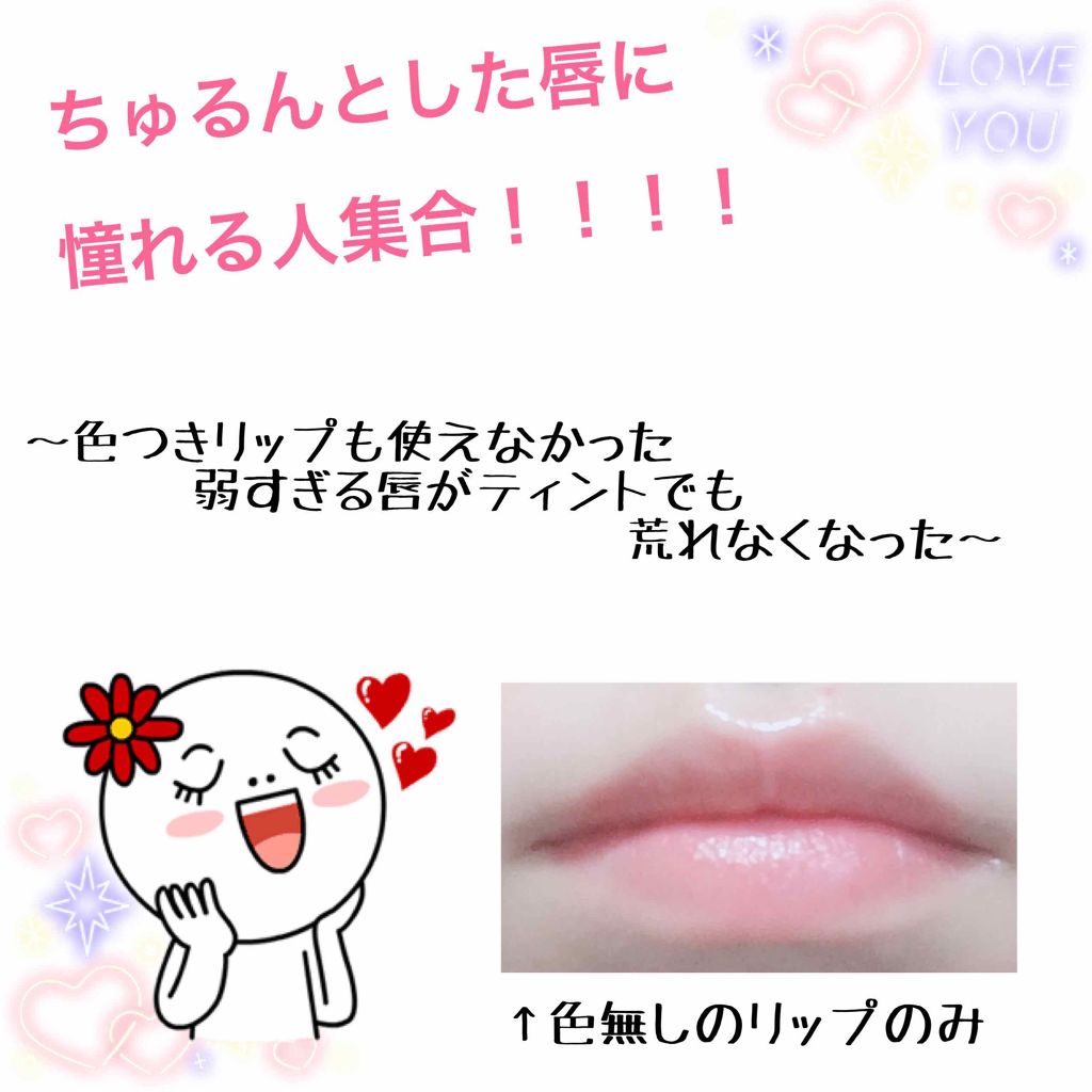 モアリップ N (医薬品)/資生堂薬品/その他を使ったクチコミ（1枚目）