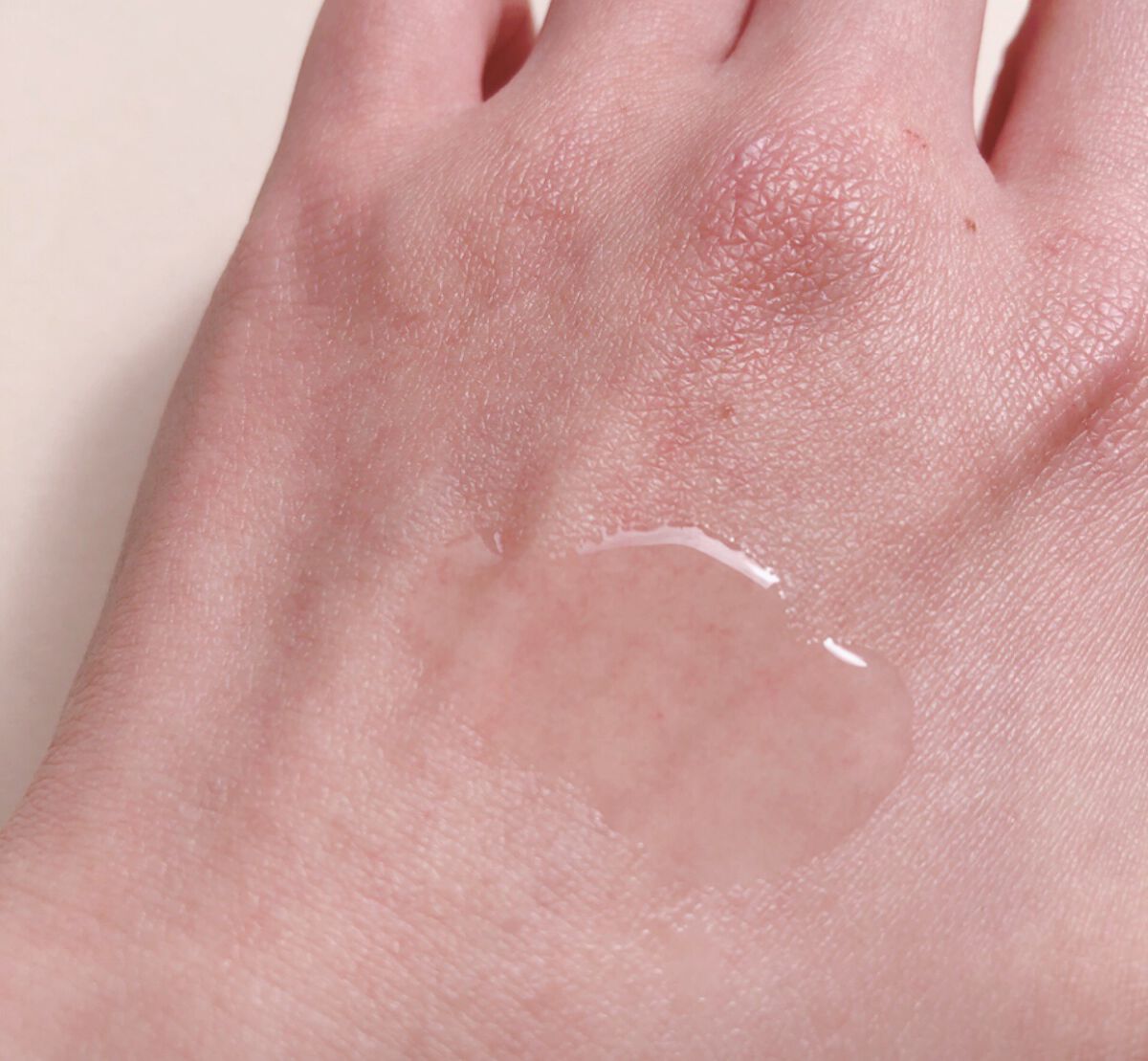 エファクラ ピールケア セラム/ラ ロッシュ ポゼ/美容液を使ったクチコミ（3枚目）