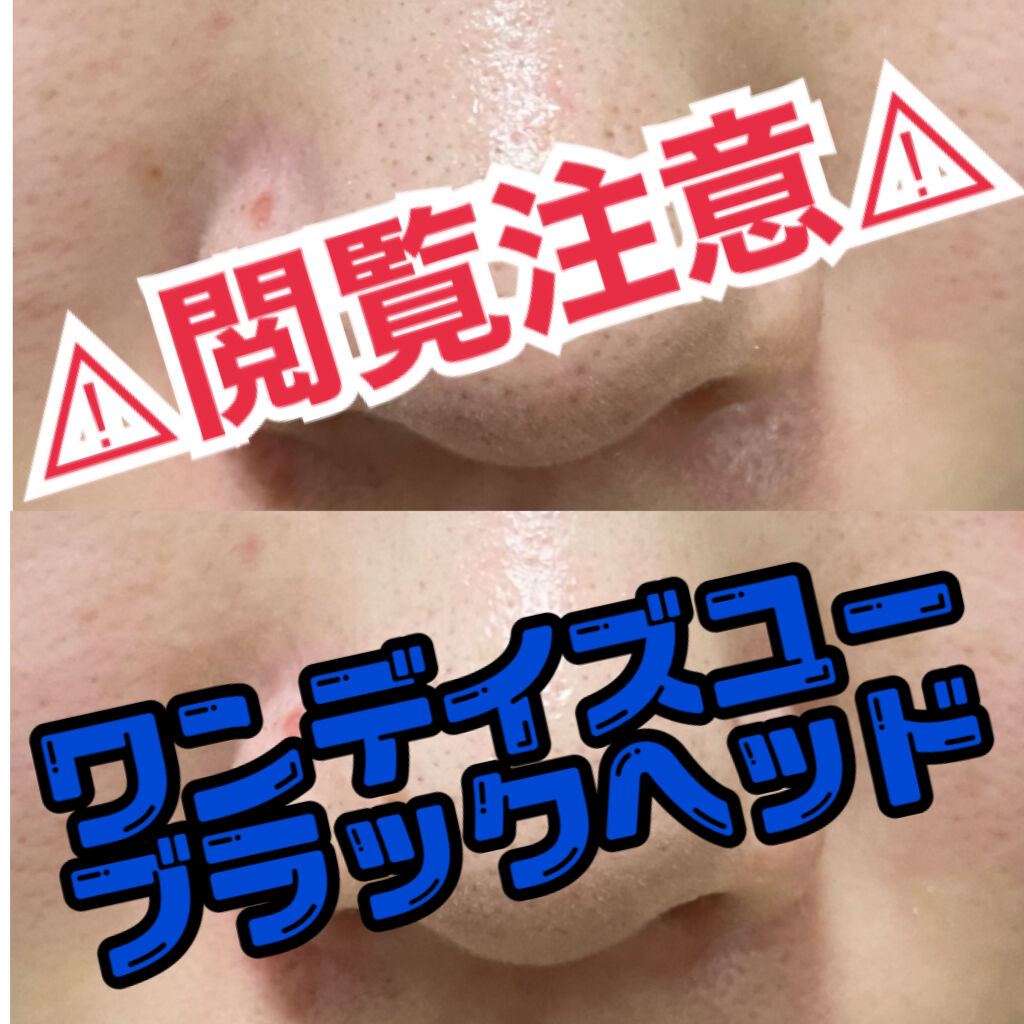 ノーモアブラックヘッド(ノーズピーリング)/One-day's you/スクラブ・ゴマージュを使ったクチコミ（1枚目）